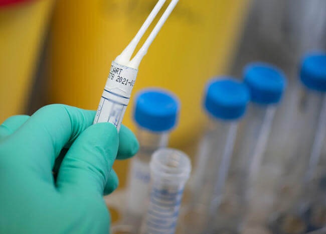 Suman 177 casos nuevos de Covid-19 y tres muertes más en el Tolima