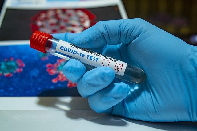 40 municipios del Tolima han registrado casos de coronavirus