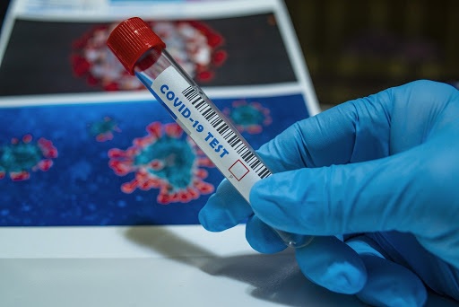 El Tolima superó los 3.000 casos de coronavirus