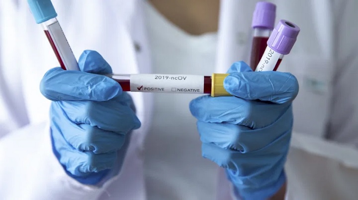 Colombia: 397.623 contagios por coronavirus y superó las 13.000 muertes