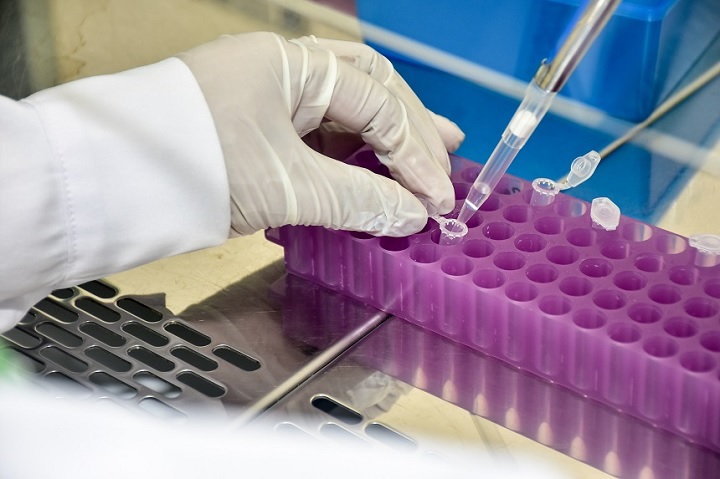 Este sábado Colombia subió a 7.285 casos de coronavirus y el Tolima a 88