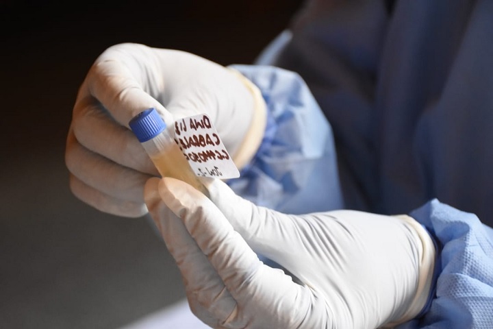 Laboratorio de Salud Pública de Ibagué, inició pruebas de PCR de Covid-19