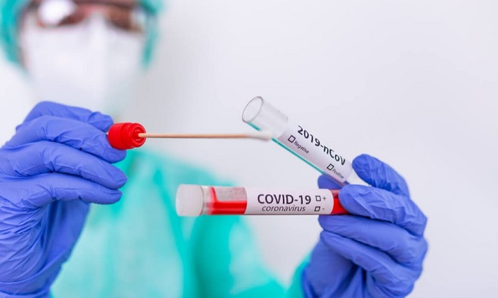 Llega primero la muerte que el resultado de Covid19