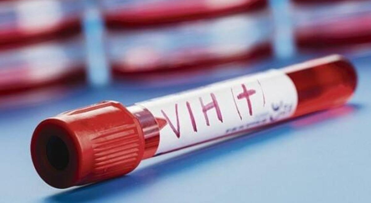 Alarmante aumento de los casos de VIH en Ibagué