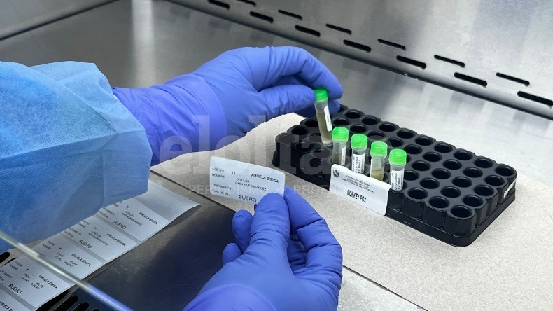 Cinco casos nuevos de viruela símica en Ibagué