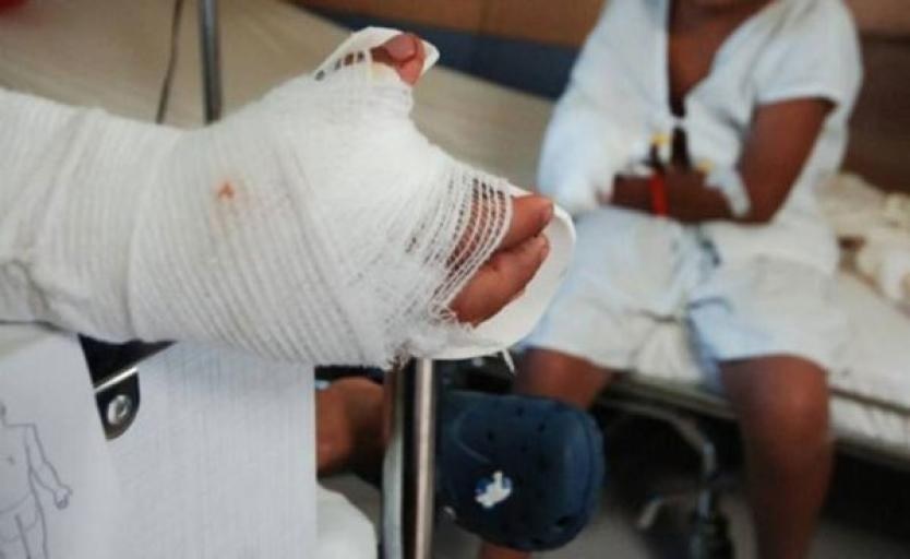 Puente festivo de Reyes cierra con un caso de quemaduras por pólvora
