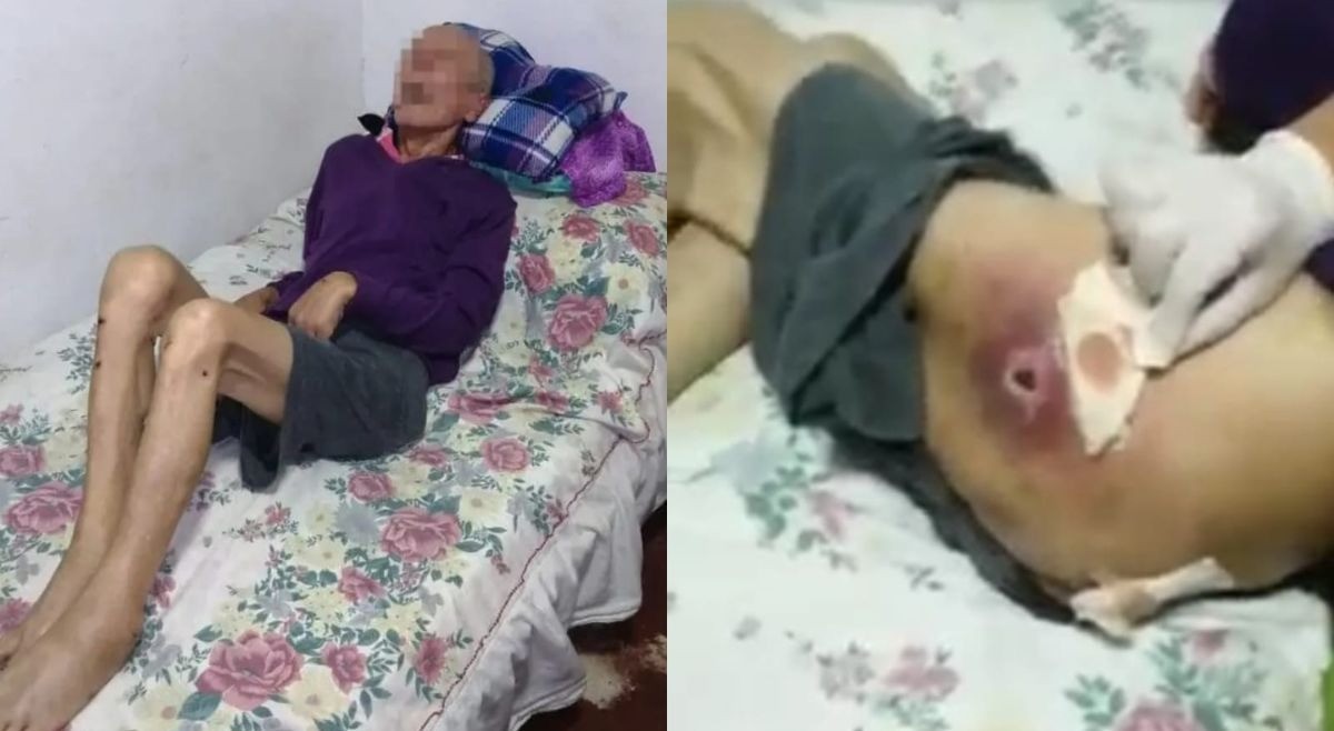 Denuncian a centro geriátrico de Ibagué por desnutrición de hombre de tercera edad