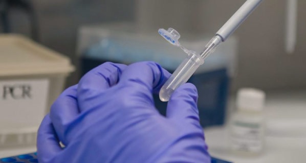 El Tolima llegó a 20 muertos por coronavirus