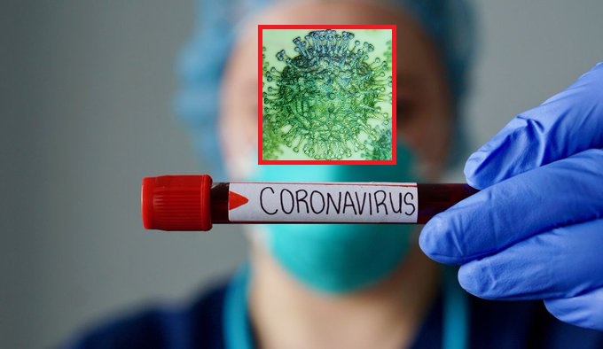 Segundo caso de coronavirus en Ibagué