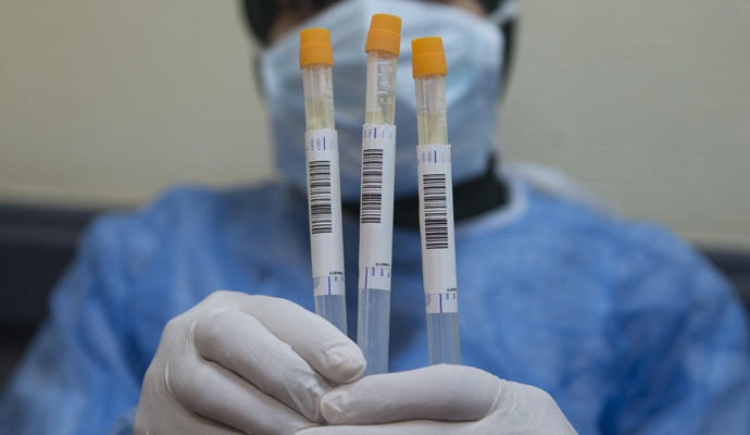 Tolima, ocho muertos más por coronavirus y 182 casos nuevos