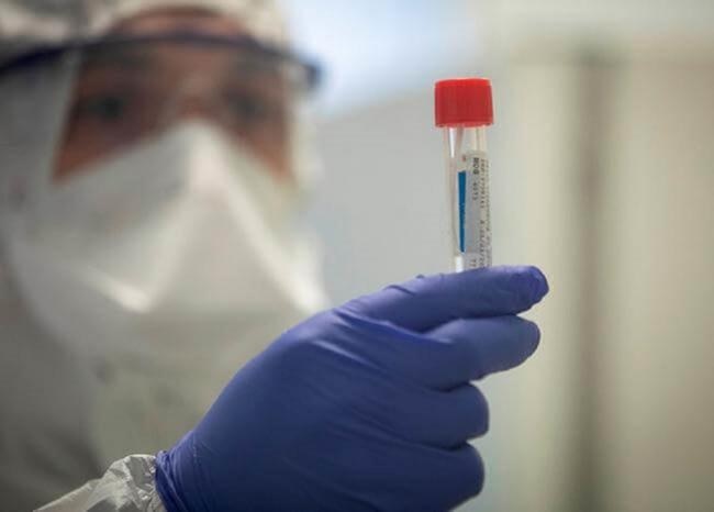 Se mantienen 42 casos de coronavirus en el Tolima