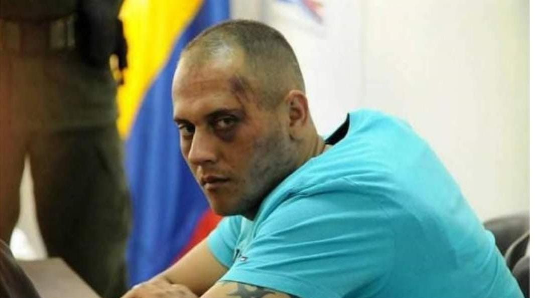 El recluso que se cosió la boca para exigir traslado a la cárcel de Ibagué