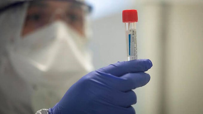 Suman 19 casos nuevos de coronavirus en el Tolima