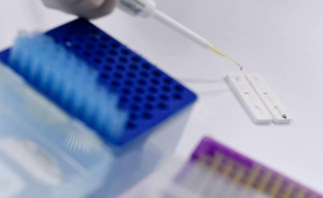 En Tolima mueren tres personas por coronavirus, y se confirman 27 casos nuevos