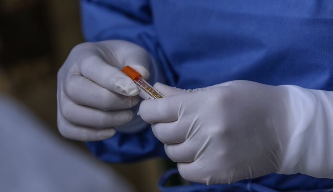 Tolima, cerca de los 400 casos de COVID - 19