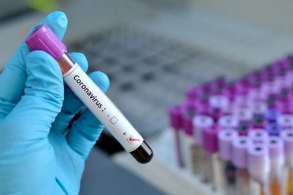 El Tolima llega a 123 muertos por covid-19 y suma 172 casos nuevos