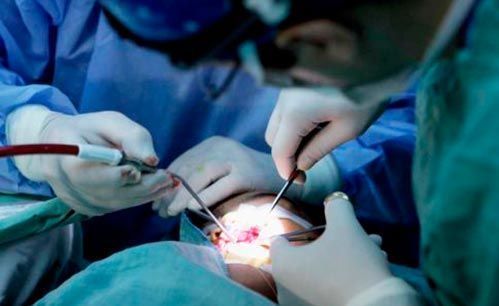 Niños con paladar hendido y labio fisurado recibirán cirugía gratuita