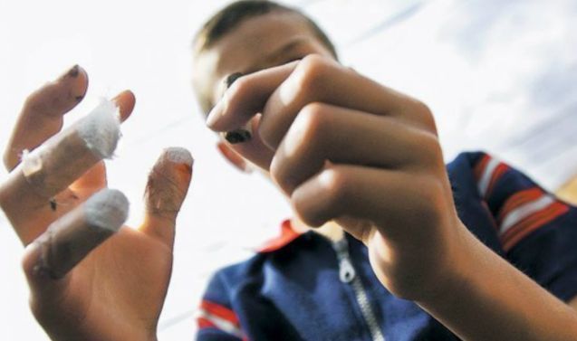 Casos de lesionados por pólvora disminuyeron un 25%