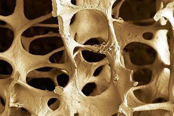 Hasta el viernes habrá jornada de prevención contra la osteoporosis