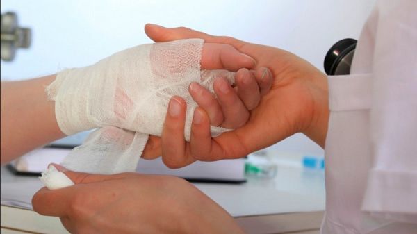 Nueve menores en el Tolima resultaron quemados con pólvora en el 2017