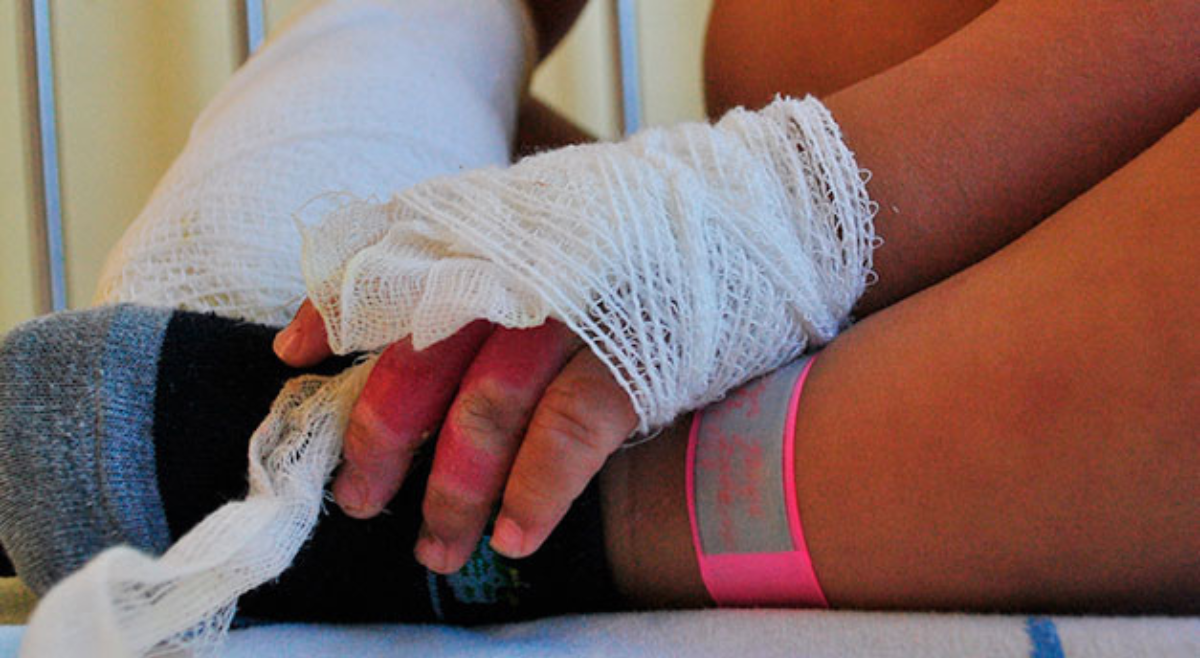 Niño de 6 años perdió una de sus manos por manipular pólvora en Ataco