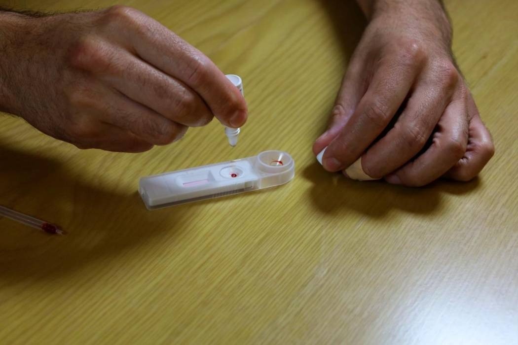 Pruebas caseras de VIH estarán disponibles próximamente en Colombia