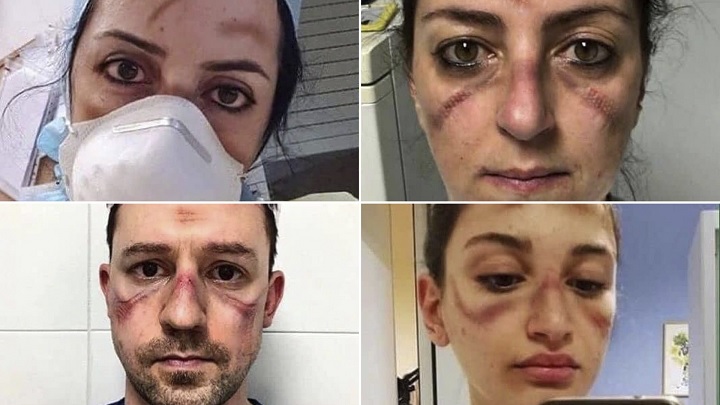 Paso a paso: Cómo cuidar tu piel mientras usas una mascarilla
