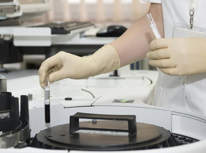 Colombia marcó récord diario con 163 muertos por coronavirus