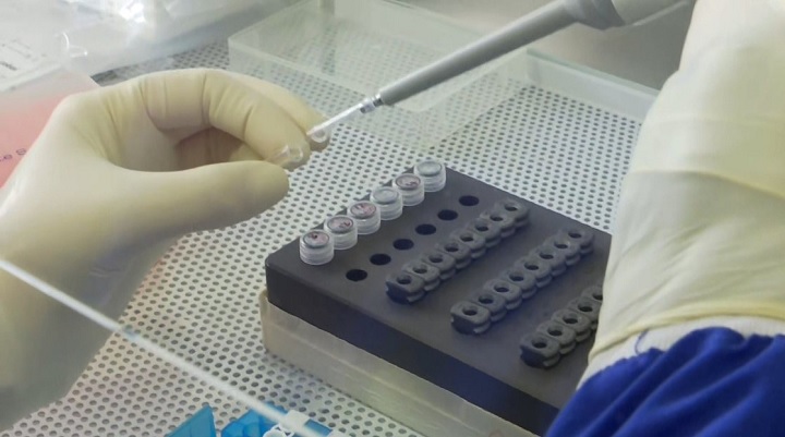 Ibagué subió a 83 casos activos de coronavirus