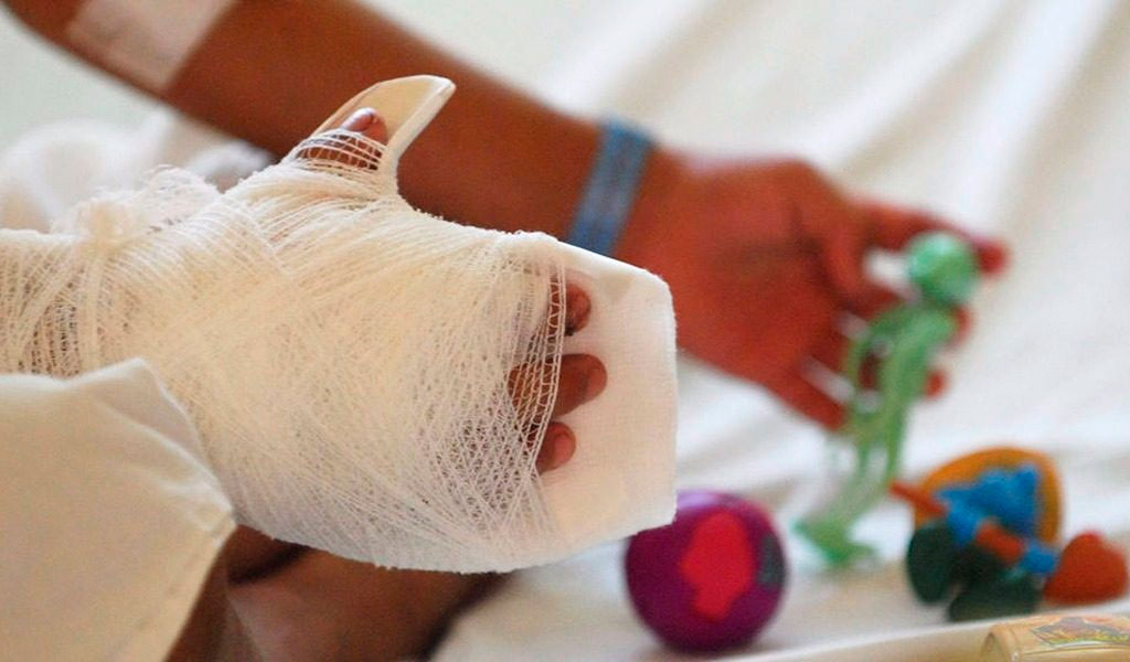 Menor de 4 años resultó lesionado por pólvora en el Líbano