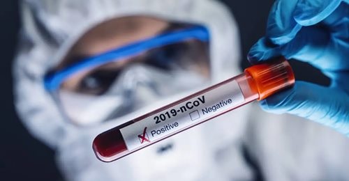 Tolima: 282 casos nuevos de covid-19 y ocho fallecidos más