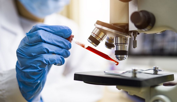El Tolima marcó récord de 187 casos de coronavirus en un día
