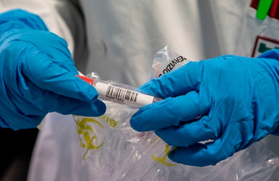 El Tolima suma 151 casos de coronavirus este sábado