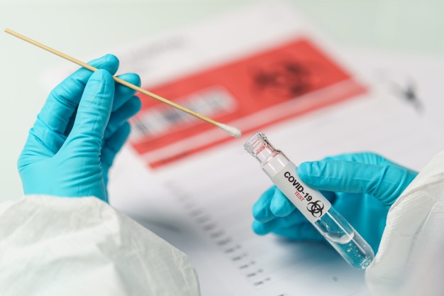 El Tolima de nuevo reporta más de 100 casos diarios de coronavirus