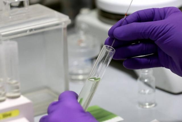 Tolima suma 169 casos de Covid-19 y tres muertes más por el virus