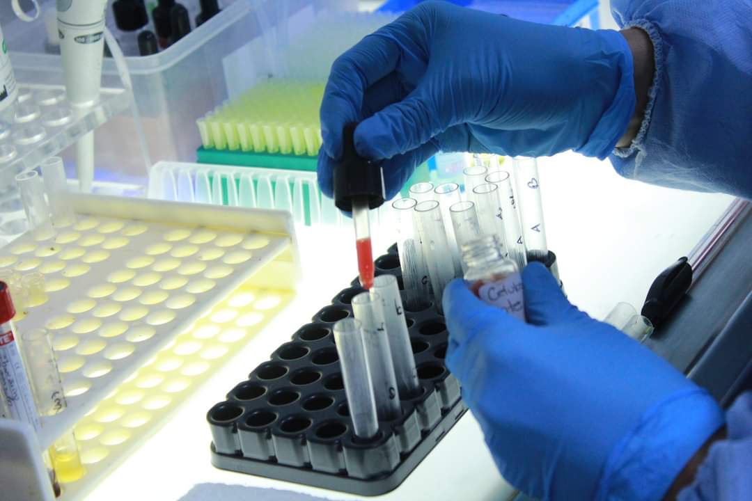 Conozca las EPS de Ibagué que recibieron nuevas vacunas contra el covid-19