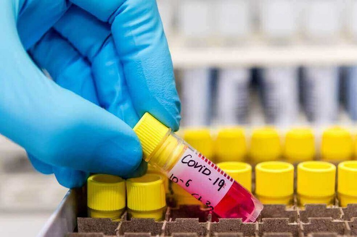 Confirmada primera muerte por coronavirus en Colombia