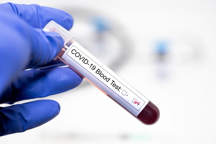 El Tolima supera los 100 casos de coronavirus