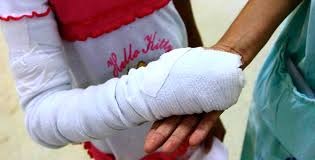38 las personas quemadas con pólvora en el Tolima